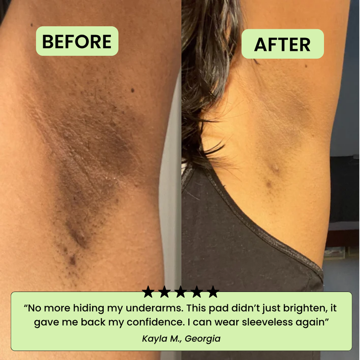 Los Pads Tonificantes Coreanos – Desvanece Manchas Oscuras y Arrugas Rápidamente