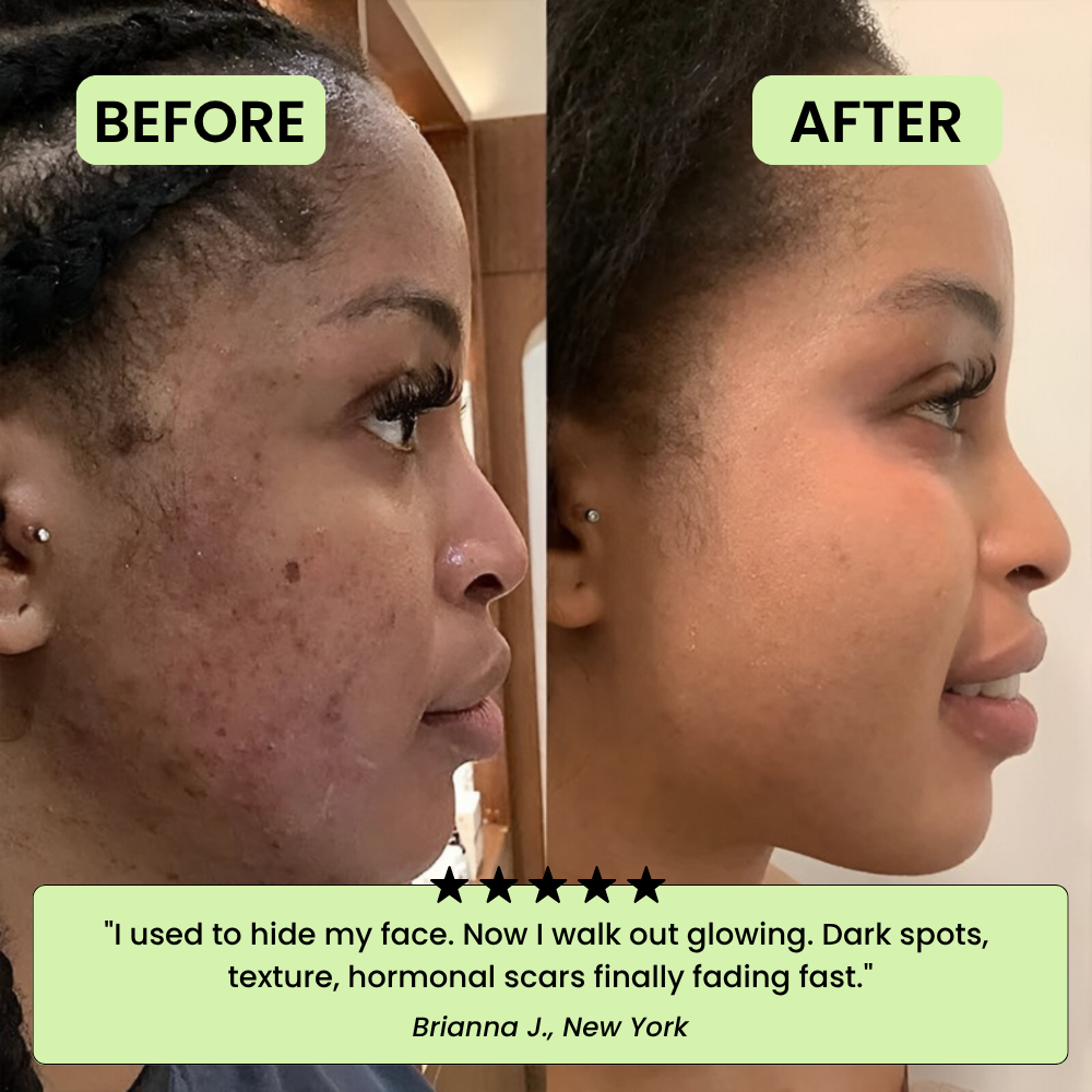 Los Pads Tonificantes Coreanos – Desvanece Manchas Oscuras y Arrugas Rápidamente