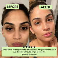 Los Pads Tonificantes Coreanos – Desvanece Manchas Oscuras y Arrugas Rápidamente