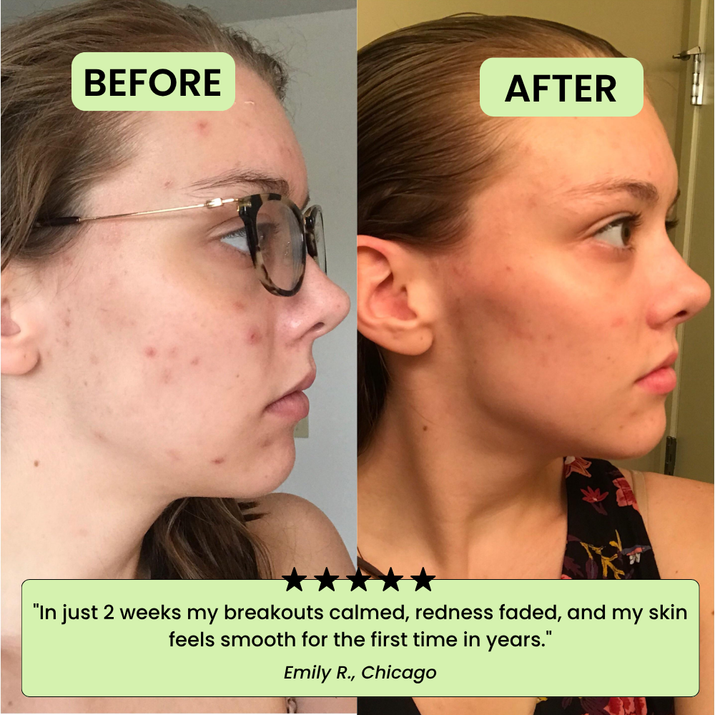 Los Pads Tonificantes Coreanos – Desvanece Manchas Oscuras y Arrugas Rápidamente