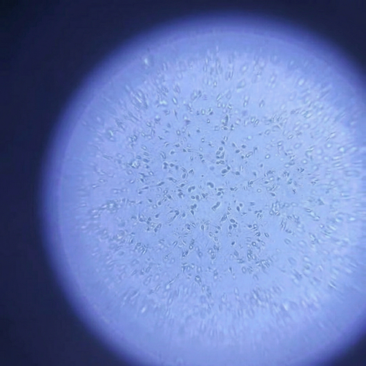 At-Home Male Sperm Test