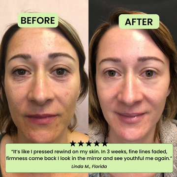 Revela una Piel Radiante y Renueva Tu Confianza